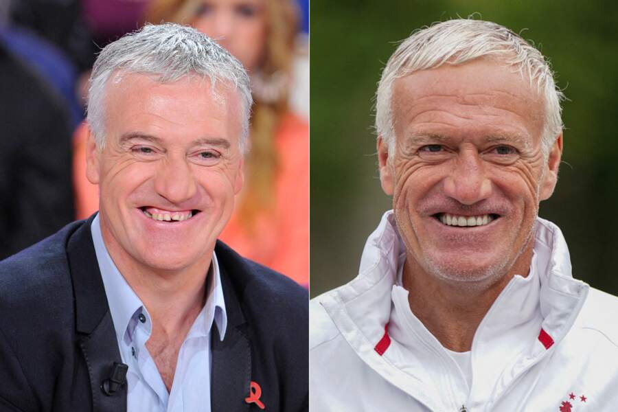 Correction Dents Abim es Stars Transformation Du Sourire En Photos